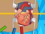 Heart Surgery