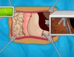 Operate Now: Stomach Surgery